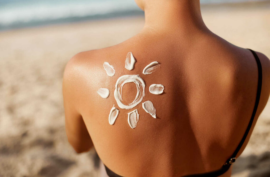 A woman at the beach with sunscreen in the shape of a sun on her back to protect her skin from UV rays and help prevent skin cancer