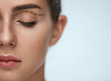What Is an Eyelid Tuck & How Does it Work?