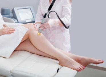 How Many Sessions of Laser Hair Removal Do You Need?