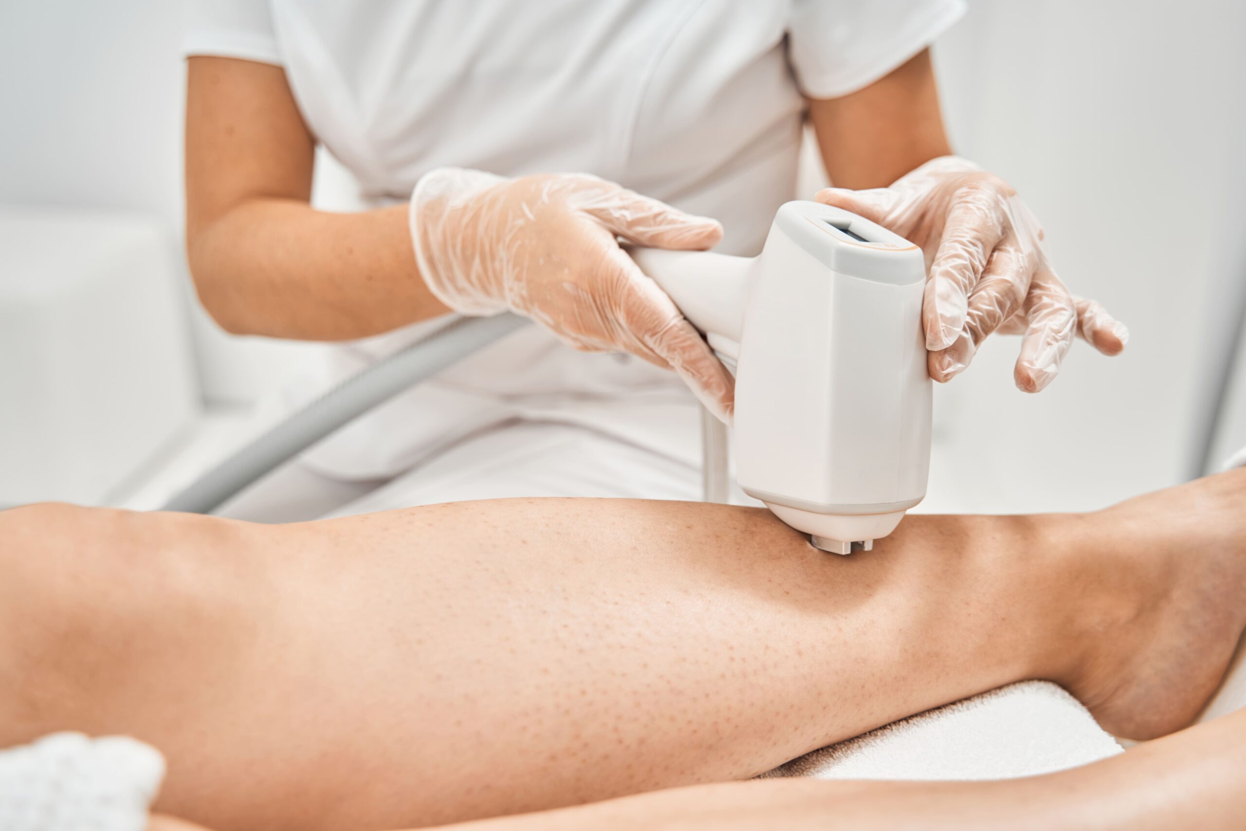Sleek and Smooth: The Benefits of Laser Hair Removal