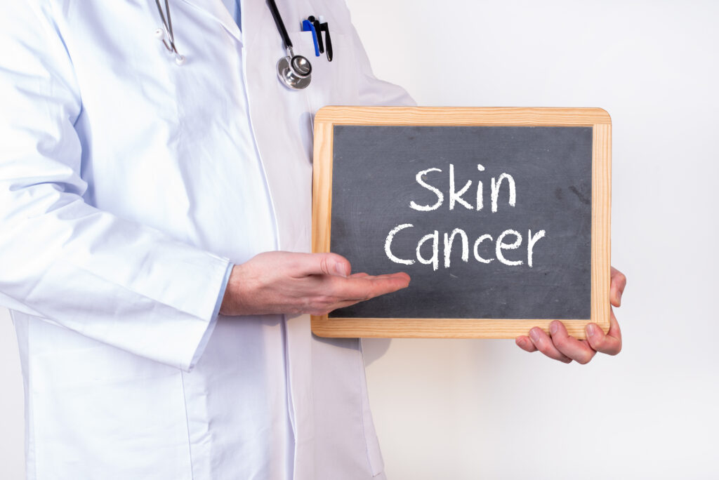 Skin Cancer Treatment