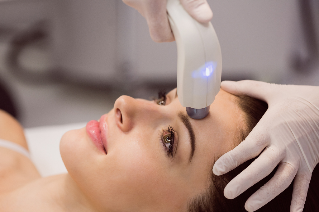 Acne Laser Face Treatment