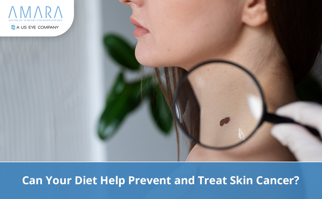 Can Your Diet Help Prevent and Treat Skin Cancer?