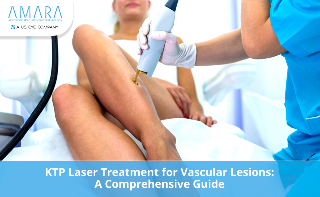 Top Questions Answered: KTP Laser Treatment for Vascular Lesions