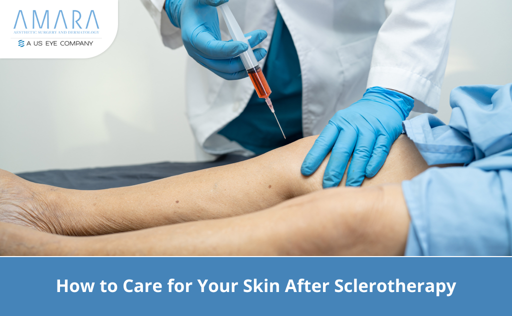 How to Care for Your Skin After Sclerotherapy