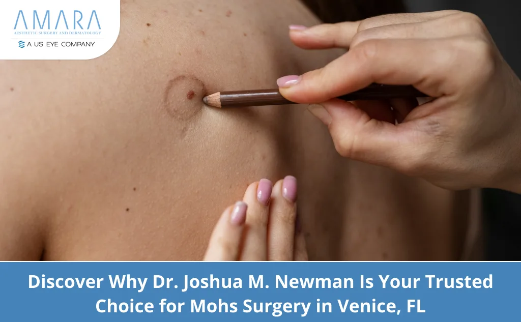 Mohs Surgery in Venice, FL by Dr. Joshua M. Newman