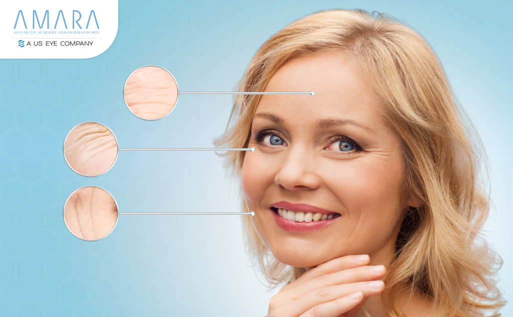 Woman showing facial lines from seasonal dryness