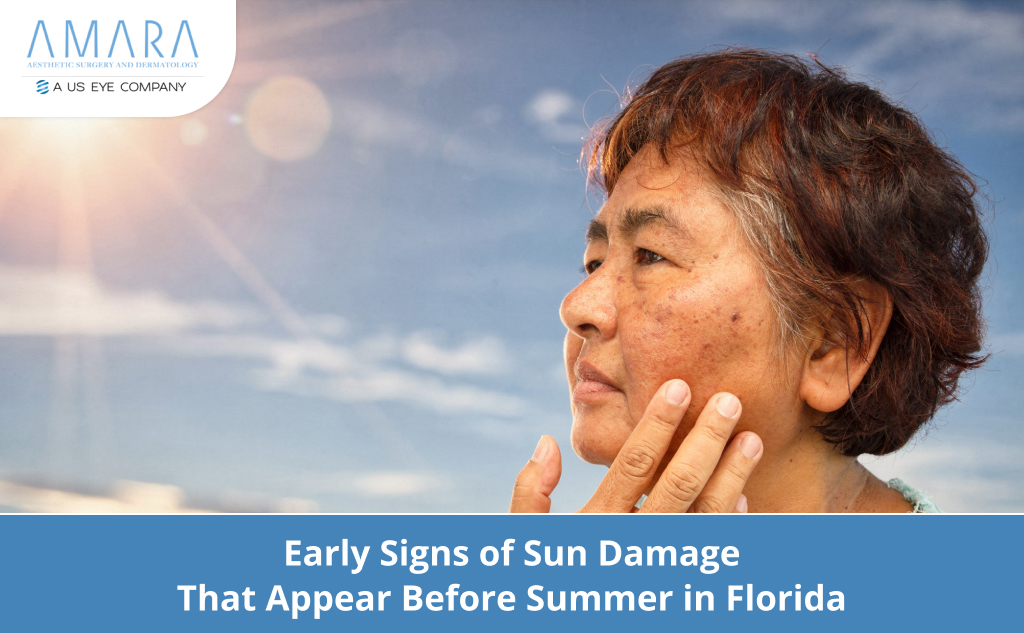 Early Signs of Sun Damage That Appear Before Summer in Florida